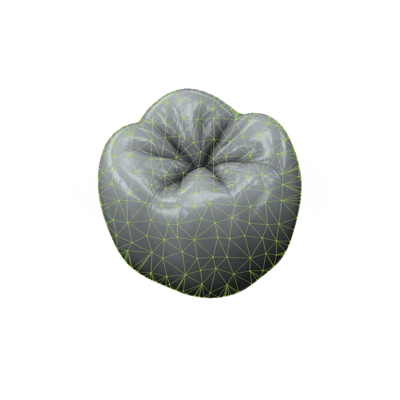 Grey scanned tooth surface with its triangle mesh, representing raw scan geometry.